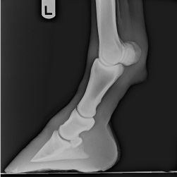 Radiograph image